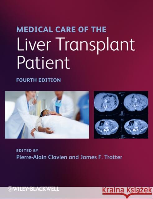 Medical Care of the Liver Transplant Patient Pierre A. Clavien Beat M?llhaupt James F. Trotter 9781444335910 Wiley-Blackwell