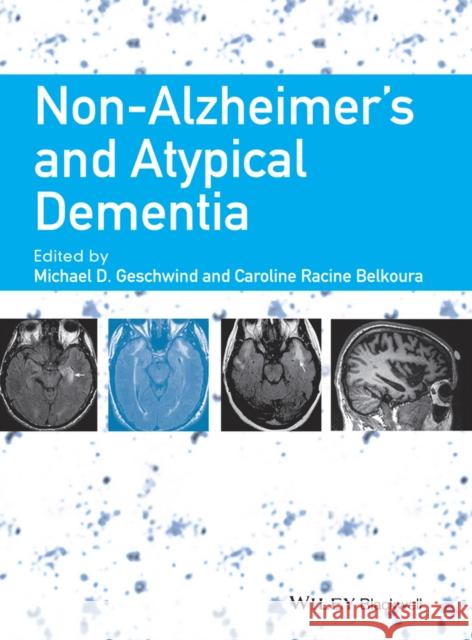 Non-Alzheimer's and Atypical Dementia Michael Geschwind Caroline Racine 9781444336245