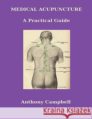Medical Acupuncture: A Practical Guide Anthony Campbell 9781445232539