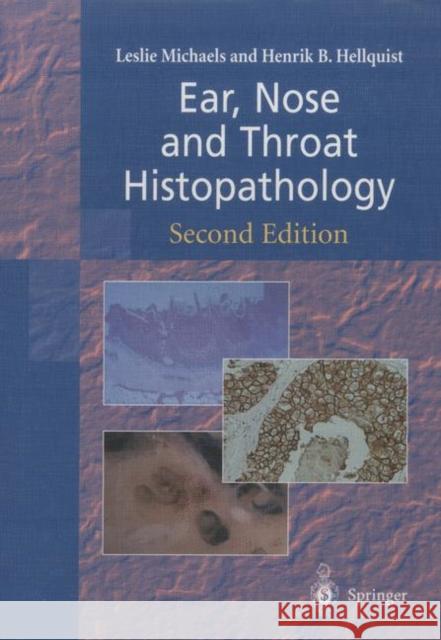 Ear, Nose and Throat Histopathology Leslie Michaels Henrik B. Hellquist 9781447111283 Springer