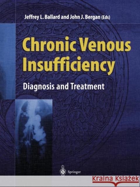 Chronic Venous Insufficiency: Diagnosis and Treatment Ballard, Jeffrey L. 9781447111498 Springer