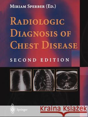 Radiologic Diagnosis of Chest Disease Miriam Sperber 9781447111795 Springer