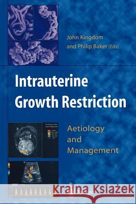Intrauterine Growth Restriction: Aetiology and Management Kingdom, John 9781447111917 Springer