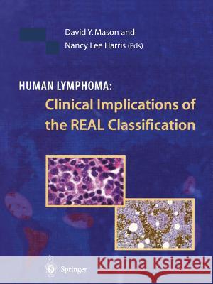 Human Lymphoma: Clinical Implications of the Real Classification Mason, David Y. 9781447112181