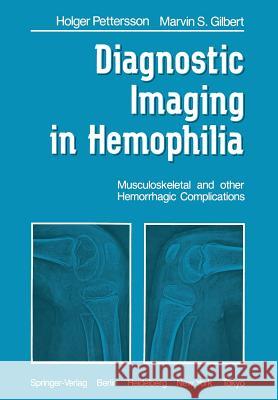 Diagnostic Imaging in Hemophilia: Musculoskeletal and Other Hemorrhagic Complications Pettersson, H. 9781447113744