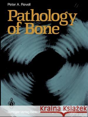 Pathology of Bone Peter A. Revell 9781447113799 Springer