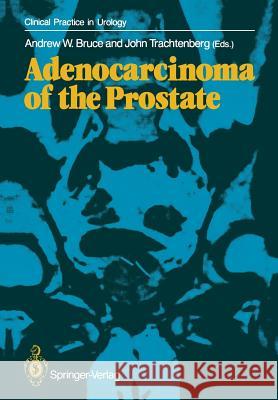 Adenocarcinoma of the Prostate Andrew W. Bruce John Trachtenberg 9781447114000 Springer