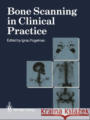 Bone Scanning in Clinical Practice Ignac Fogelman 9781447114093 Springer