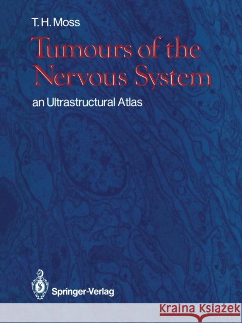 Tumours of the Nervous System: An Ultrastructural Atlas Moss, Timothy H. 9781447114284