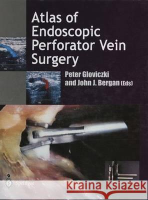 Atlas of Endoscopic Perforator Vein Surgery Peter Gloviczki John Bergan 9781447115298 Springer