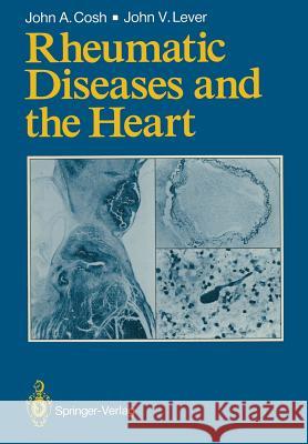 Rheumatic Diseases and the Heart John A. Cosh John V. Lever 9781447116455