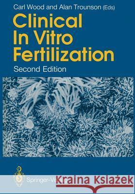 Clinical in Vitro Fertilization Wood, Carl 9781447116660 Springer