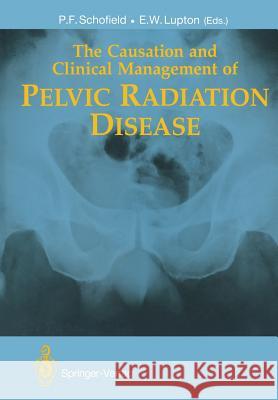 The Causation and Clinical Management of Pelvic Radiation Disease Philip F. Schofield Eric W. Lupton S. Goldberg 9781447117063