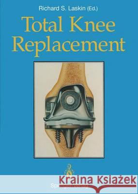 Total Knee Replacement Andrew S. Turtel 9781447118275 Springer