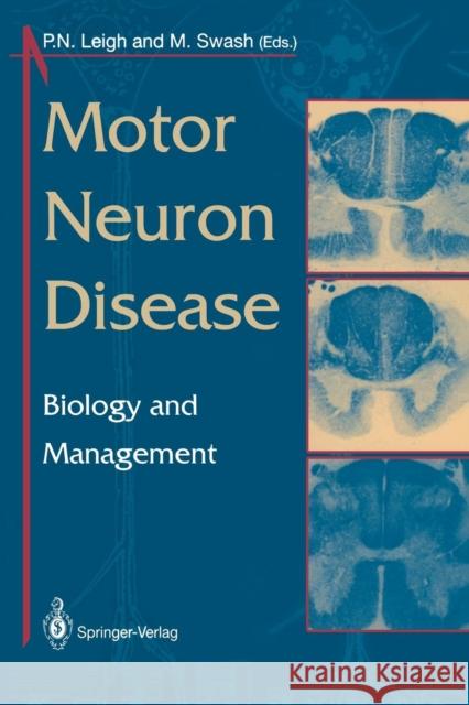 Motor Neuron Disease: Biology and Management Leigh, P. N. 9781447118732 Springer