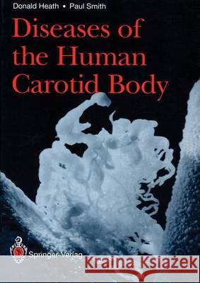 Diseases of the Human Carotid Body Donald Heath Paul Smith 9781447118763 Springer