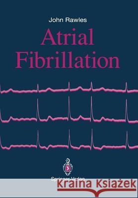 Atrial Fibrillation John Rawles 9781447119005