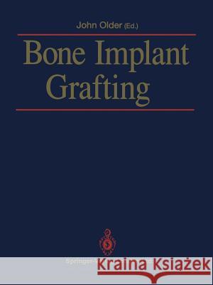 Bone Implant Grafting John Older 9781447119364 Springer