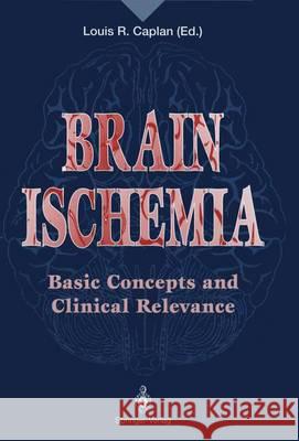 Brain Ischemia: Basic Concepts and Clinical Relevance Caplan, Louis R. 9781447120759 Springer