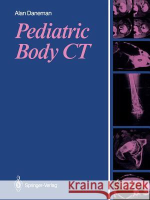 Pediatric Body CT Alan Daneman 9781447131397 Springer