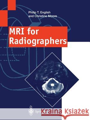 MRI for Radiographers Philip T. English Christine Moore 9781447134053 Springer