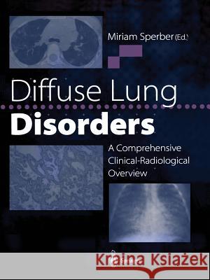 Diffuse Lung Disorders: A Comprehensive Clinical-Radiological Overview Sperber, Miriam 9781447134428 Springer