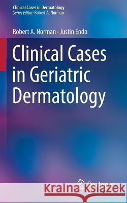 Clinical Cases in Geriatric Dermatology Robert A Norman 9781447141341 Springer, Berlin