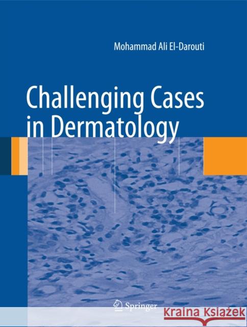 Challenging Cases in Dermatology Mohammad Ali El-Darouti 9781447142485 Springer