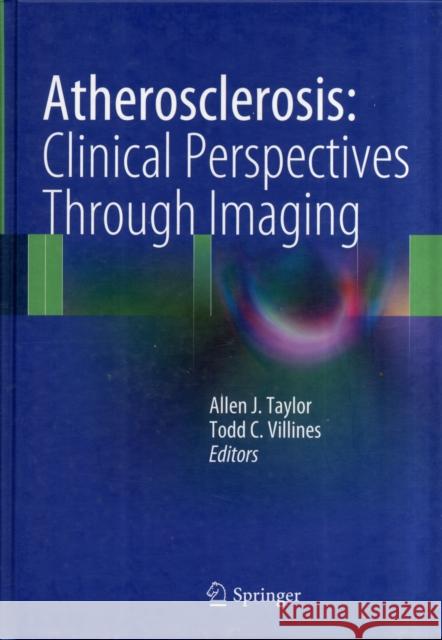 Atherosclerosis: Clinical Perspectives Through Imaging Taylor, Allen J. 9781447142874