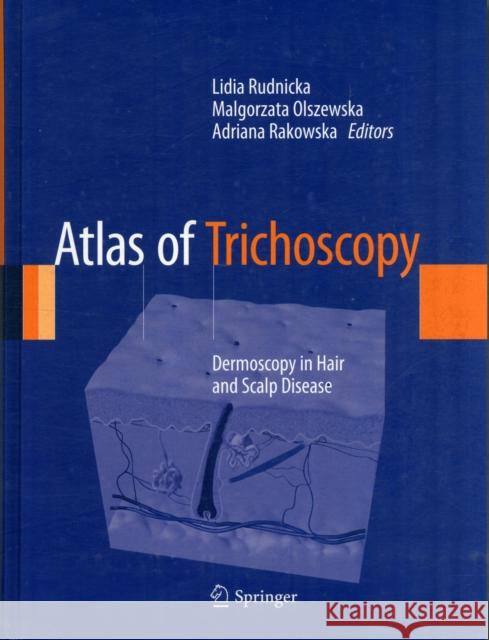 Atlas of Trichoscopy: Dermoscopy in Hair and Scalp Disease Rudnicka, Lidia 9781447144854 Springer