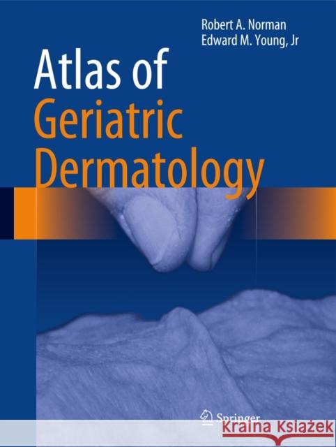 Atlas of Geriatric Dermatology Robert A. Norman Ed Young 9781447145783 Springer