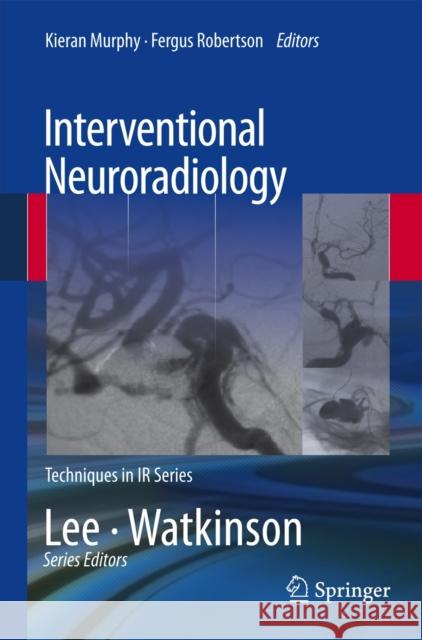 Interventional Neuroradiology Fergus Robertson 9781447145813 0