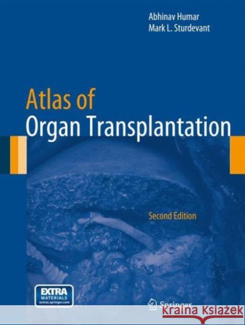 Atlas of Organ Transplantation Abhinav Ed Humar 9781447147749