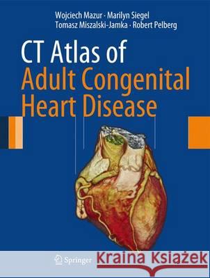 CT Atlas of Adult Congenital Heart Disease Mazur, Wojciech|||Siegel, Marilyn J.|||Miszalski-Jamka, Tomasz 9781447150879