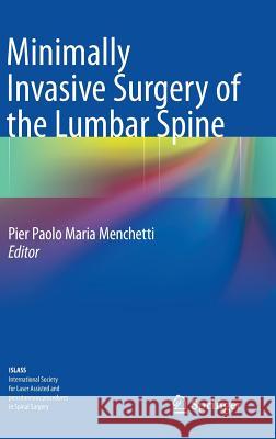 Minimally Invasive Surgery of the Lumbar Spine Pier Paolo Maria Menchetti 9781447152798 Springer