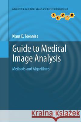 Guide to Medical Image Analysis: Methods and Algorithms Toennies, Klaus D. 9781447160960 Springer