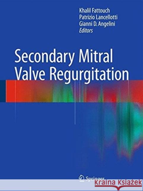 Secondary Mitral Valve Regurgitation Fattouch, Khalil 9781447164876 Springer