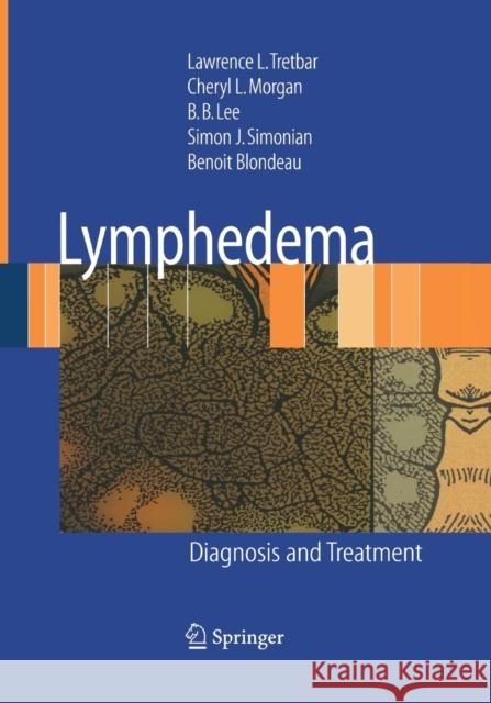 Lymphedema: Diagnosis and Treatment Tretbar, Lawrence L. 9781447168171