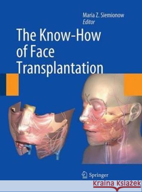 The Know-How of Face Transplantation Maria Z. Siemionow 9781447168973 Springer