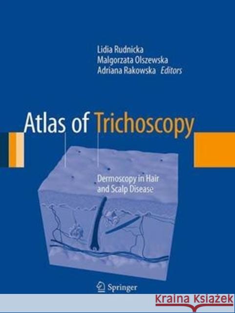 Atlas of Trichoscopy: Dermoscopy in Hair and Scalp Disease Rudnicka, Lidia 9781447170082 