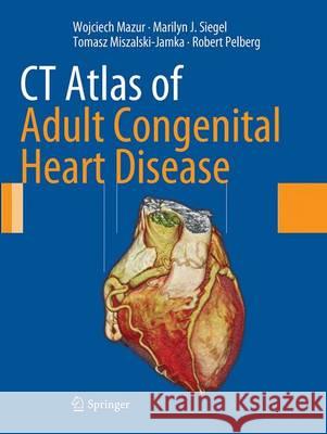 CT Atlas of Adult Congenital Heart Disease Wojciech Mazur Marilyn J. Siegel Tomasz Miszalski-Jamka 9781447170679