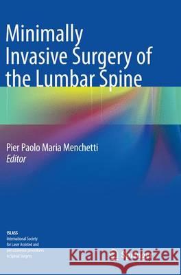 Minimally Invasive Surgery of the Lumbar Spine Pier Paolo Maria Menchetti 9781447170877 Springer