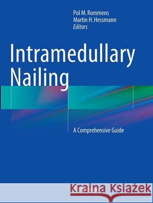 Intramedullary Nailing: A Comprehensive Guide Rommens, Pol M. 9781447171102 Springer