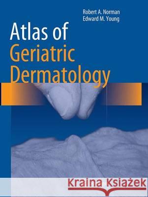 Atlas of Geriatric Dermatology Robert A. Norman Edward M. Youn 9781447171577 Springer