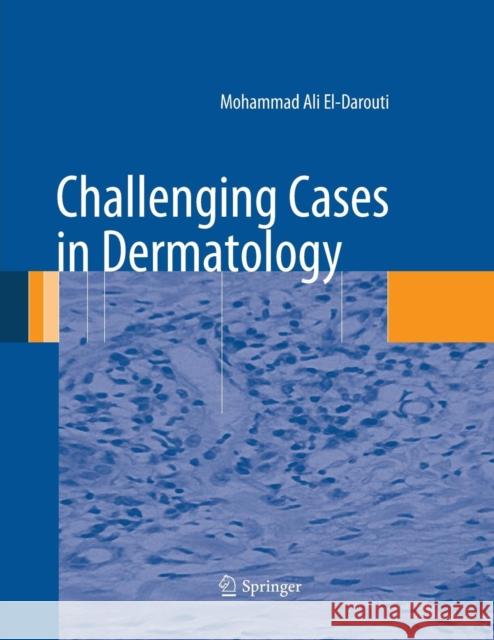Challenging Cases in Dermatology Mohammad Ali El-Darouti 9781447171997 Springer