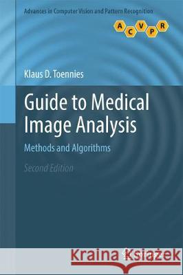 Guide to Medical Image Analysis: Methods and Algorithms Toennies, Klaus D. 9781447173182 Springer