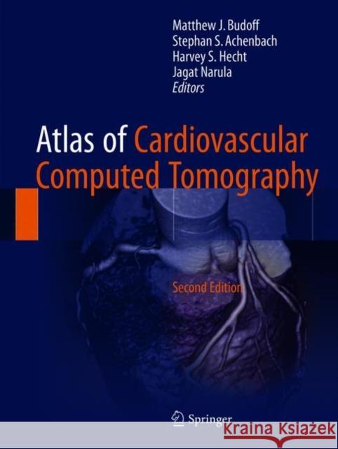 Atlas of Cardiovascular Computed Tomography Matthew J. Budoff Stephan S. Achenbach Harvey S. Hecht 9781447173564 Springer