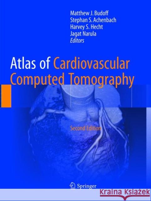 Atlas of Cardiovascular Computed Tomography Matthew J. Budoff Stephan S. Achenbach Harvey S. Hecht 9781447174332 Springer