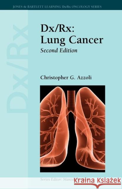 DX/Rx: Lung Cancer: Lung Cancer Azzoli, Christopher G. 9781449600396 Jones and Bartlett Publishers, Inc