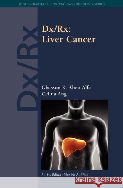 DX/Rx: Liver Cancer: Liver Cancer Abou-Alfa, Ghassan K. 9781449646868